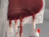 Close-up of a medical blood bag filled with red blood, showing attached tubes and connectors against a blurred background.